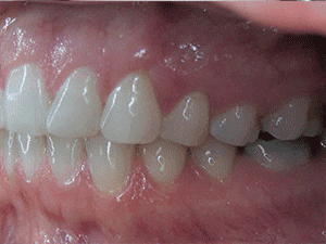 Virtual Retainer Check