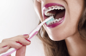 How to Care for Your Braces at School