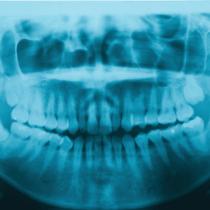 Orthodontic X-Rays Parks Orthodontics