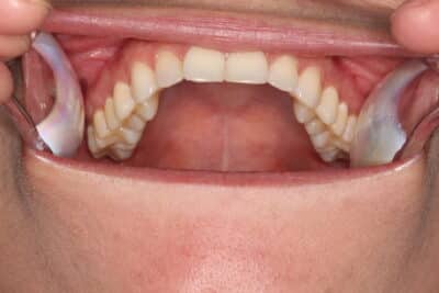 Virtual Retainer Check