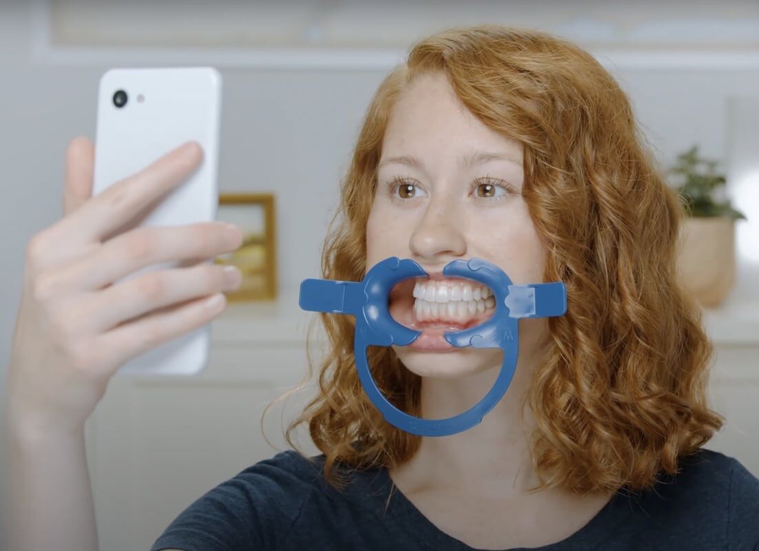 Remote Patient Invisalign Virtual Care Selfie AI Smile Orthodontic Treatment